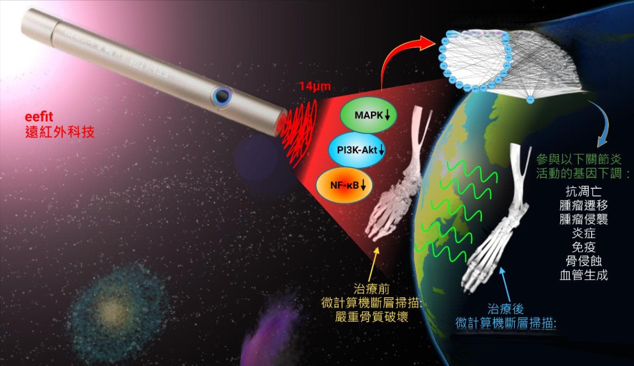 澳科大团队探索类风湿性关节炎的治疗：从细胞机制到创新疗法