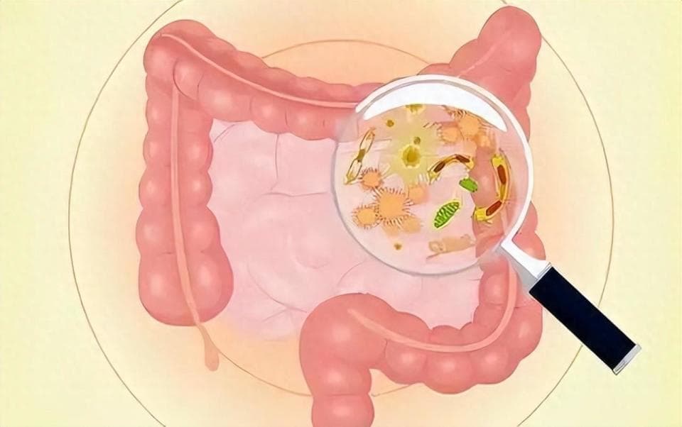 肠炎患者的饮食指南：健康从“肠”开始