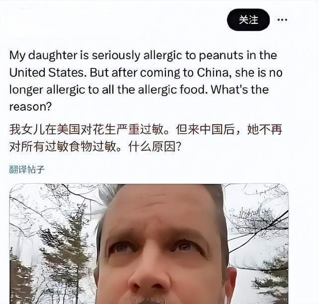 来中国后花生过敏消失了？医生解释跨国食物过敏之谜