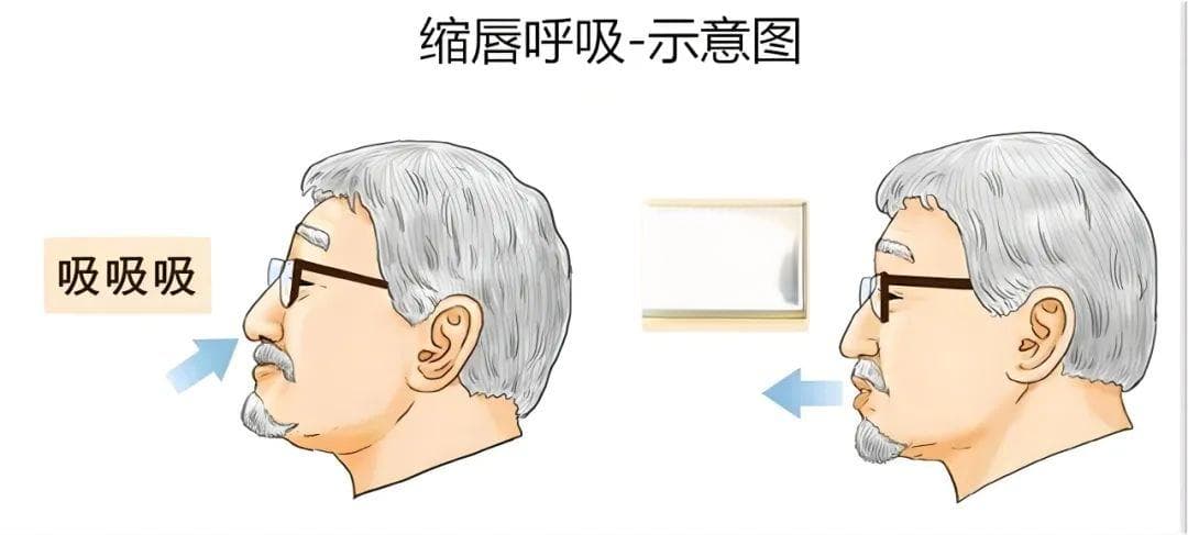 慢阻肺患者如何正确进行缩唇呼吸？