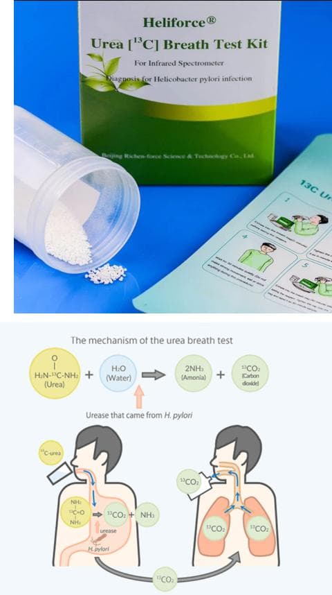 碳-13（13C）呼气试验在消化系统疾病诊断中的应用