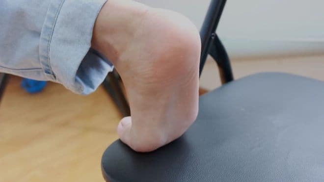 脚后跟经常“干裂”？可能和这几个因素有关，若你有，请多加注意