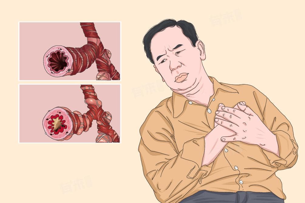 哮喘是怎么形成的