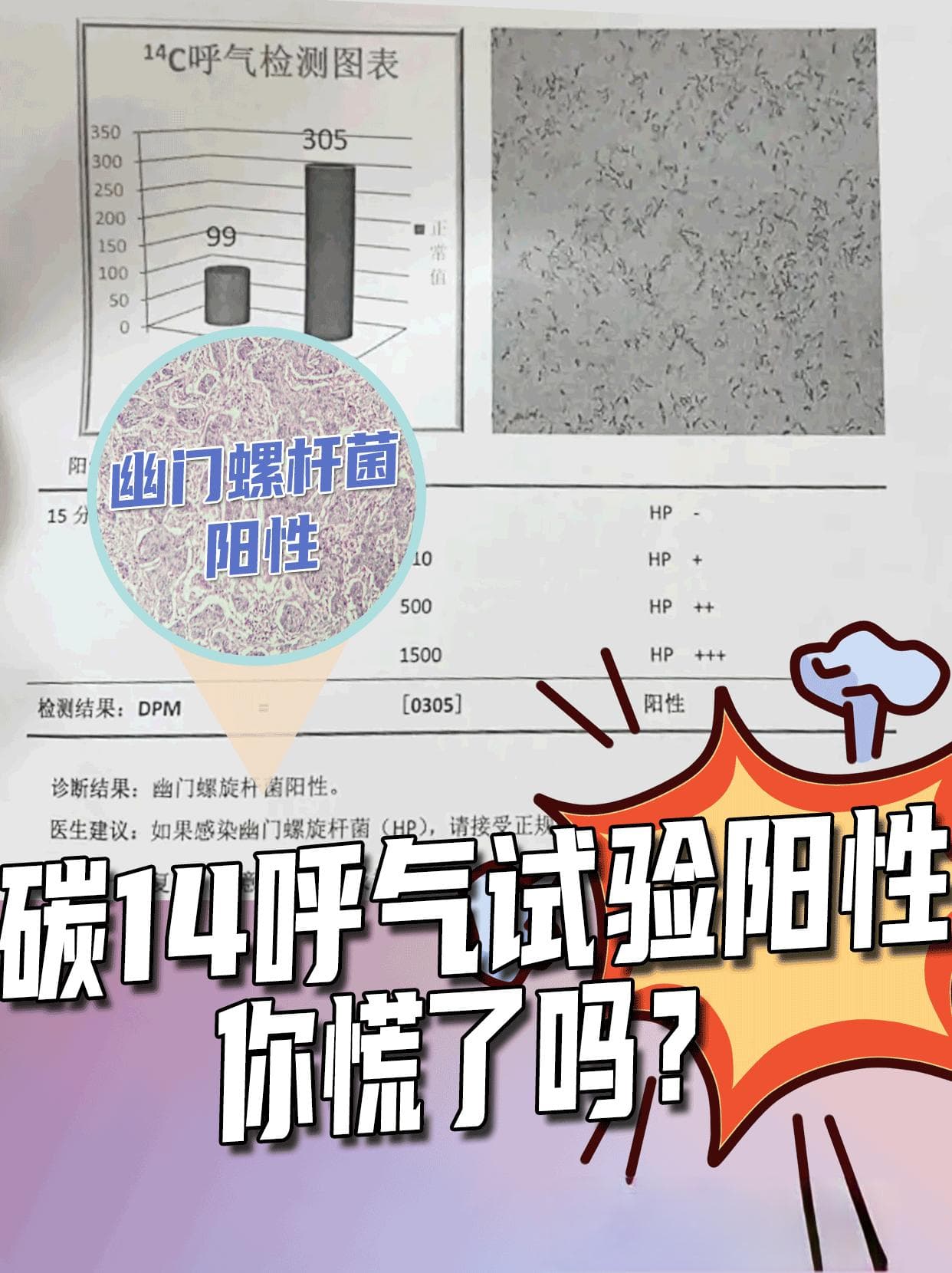 碳14呼气试验阳性可治愈，六步规范治疗助康复