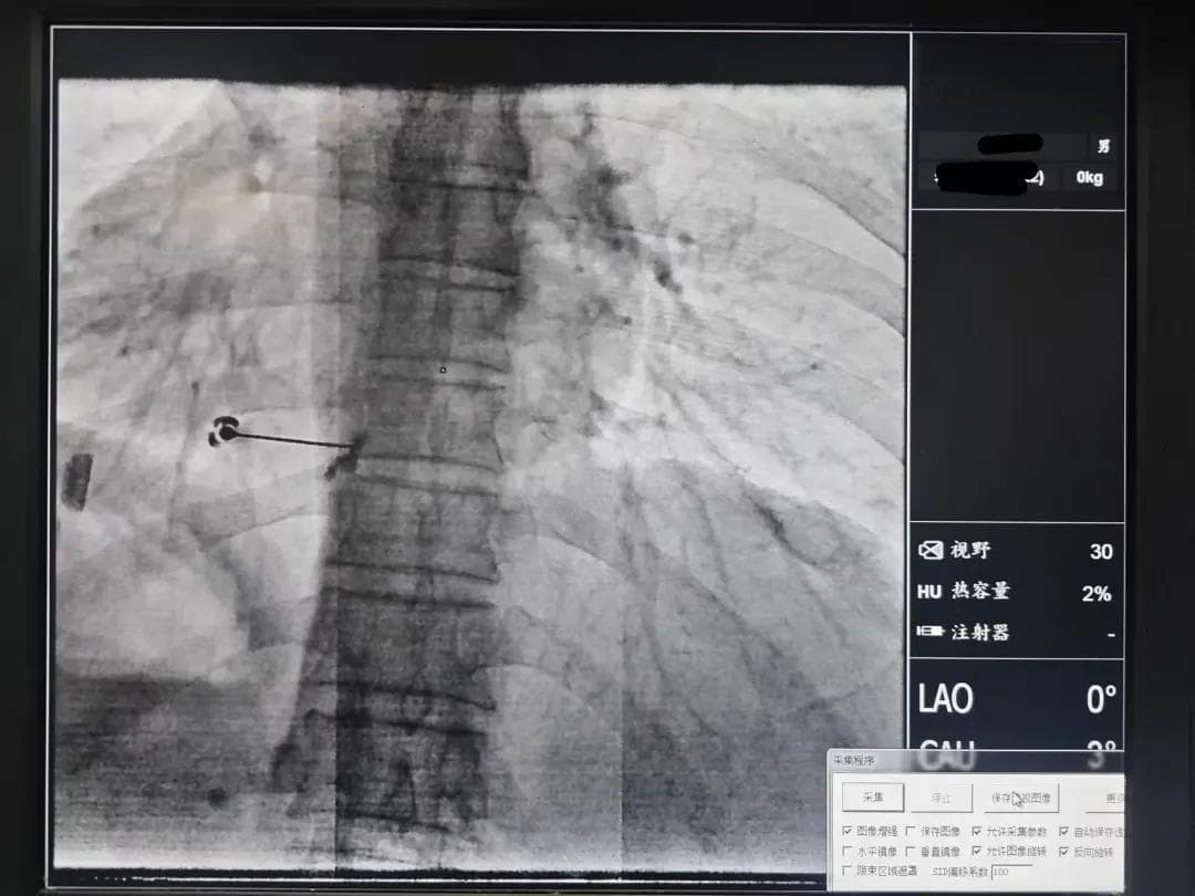 【健康科普】蛇年莫要“蛇缠腰”，带状疱疹及后遗神经痛的防治攻略