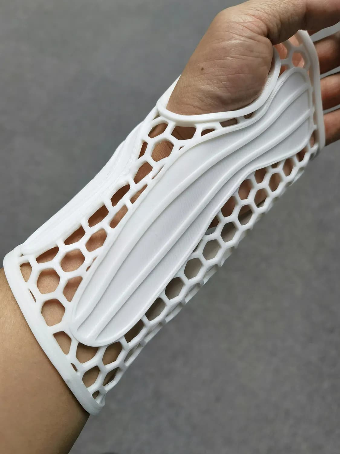 骨肉瘤治疗迎来新突破！3D打印、新药研发和免疫疗法带来新希望