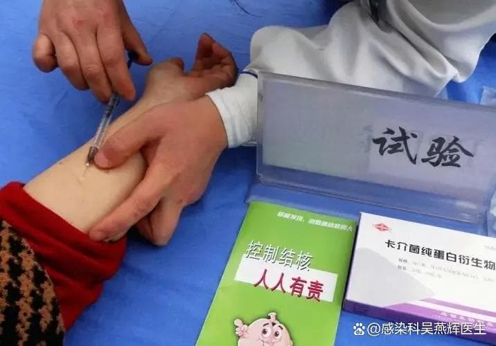 TST阳性就是得结核病？解读结核菌素皮肤试验