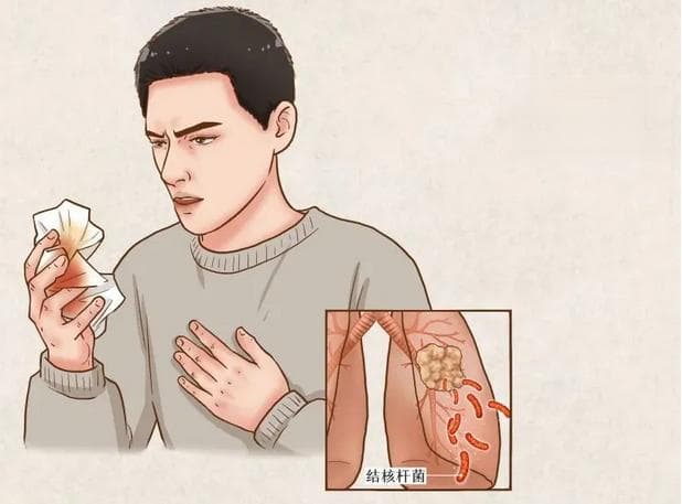 世界防治结核病日 | 结核病如何传染？如何预防？