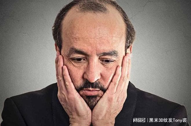 纹发是什么技术？从原理到效果，一文带你了解这项创新美容术