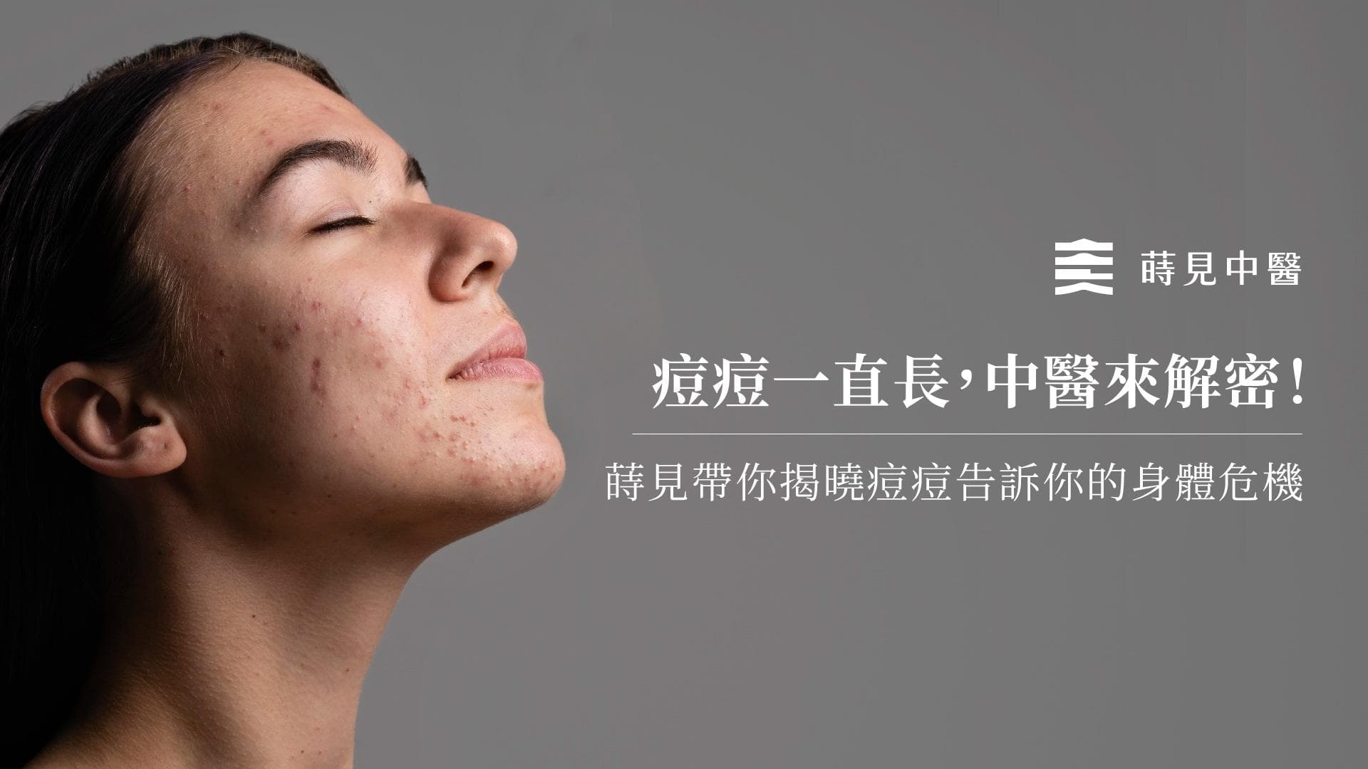 痘痘一直长，中医来解密！不同位置的痘痘代表什么身体警讯？