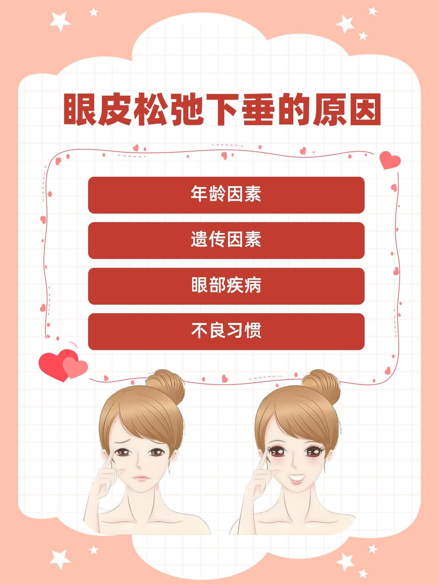 重塑紧致：眼皮松弛下垂的自然与手术对策