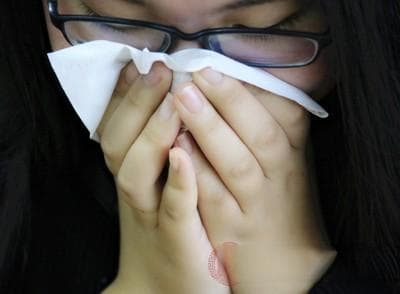 鼻炎怎么办？这些方法可改善鼻炎症状