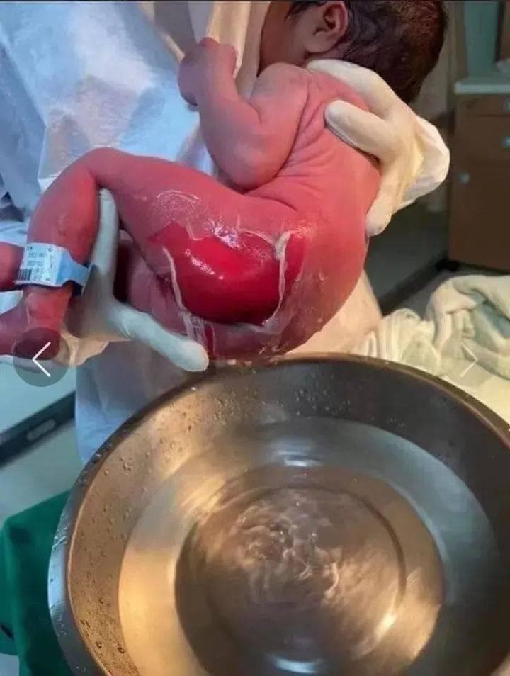 新生儿洗澡酿惨剧！给所有医护敲响警钟！正确的步骤是……