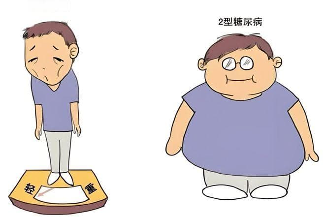 糖尿病的常见类型及诊断