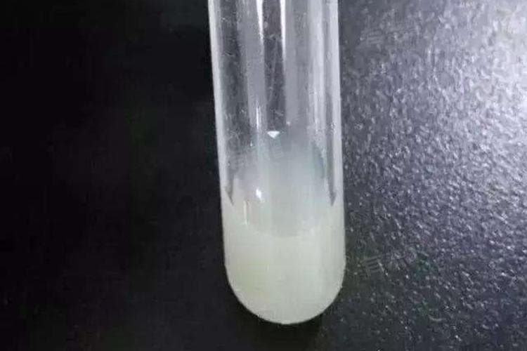 为什么尿是白色的？可能病因及检查方法全解析