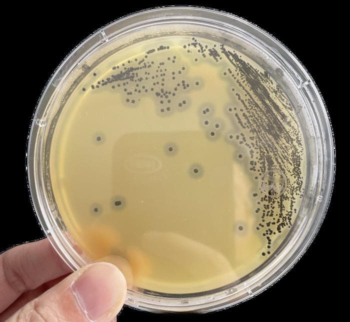 微生物菌落形态图汇总