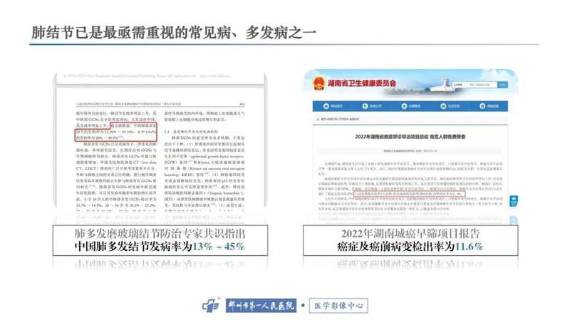 肺结节精准CT检查技术：4大不足与10项改进措施