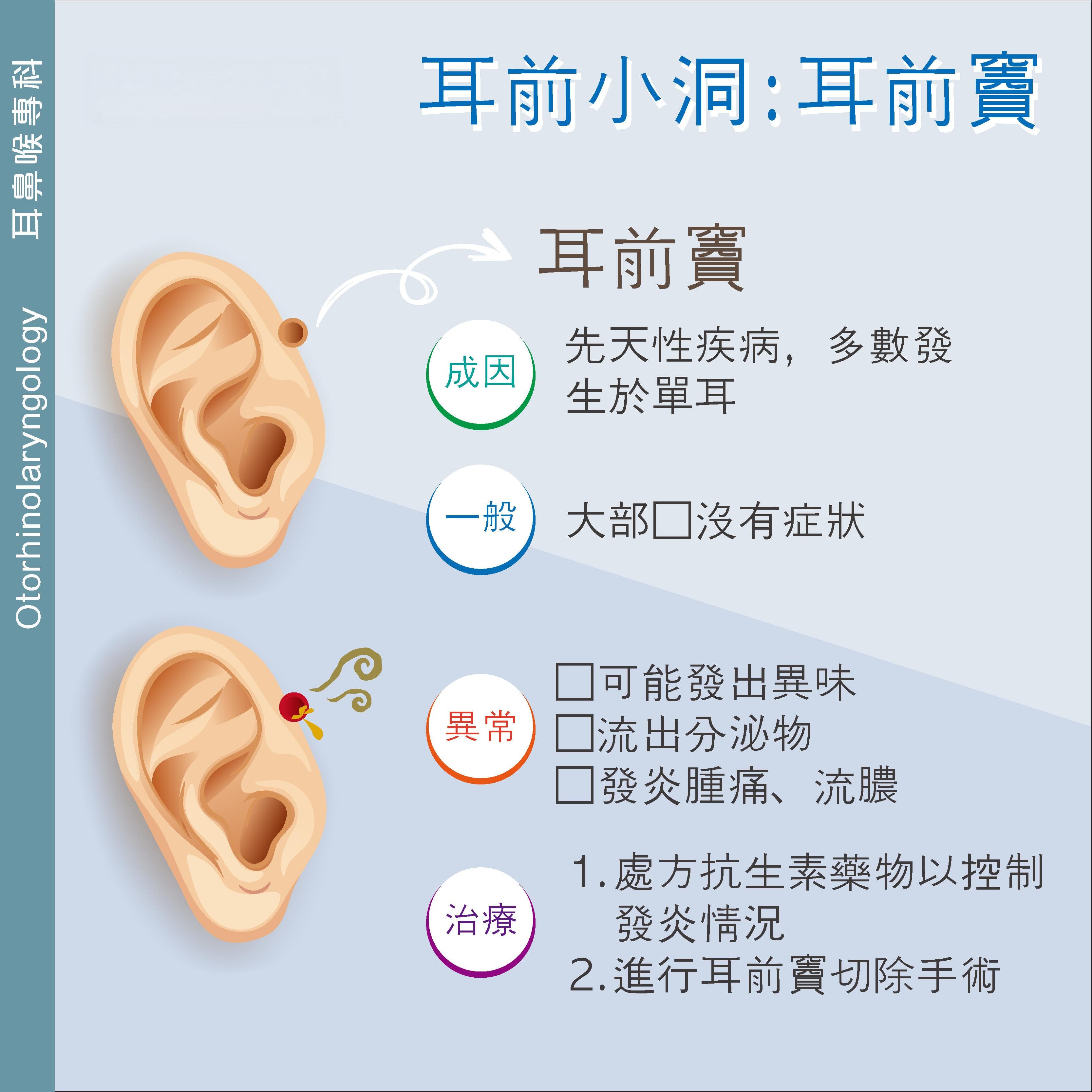 耳前窦切除术：定义、症状、手术步骤及术后护理全解析