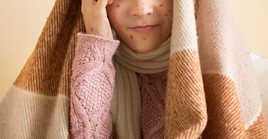 小孩落枕：原因、处理方法、用药及恢复时间