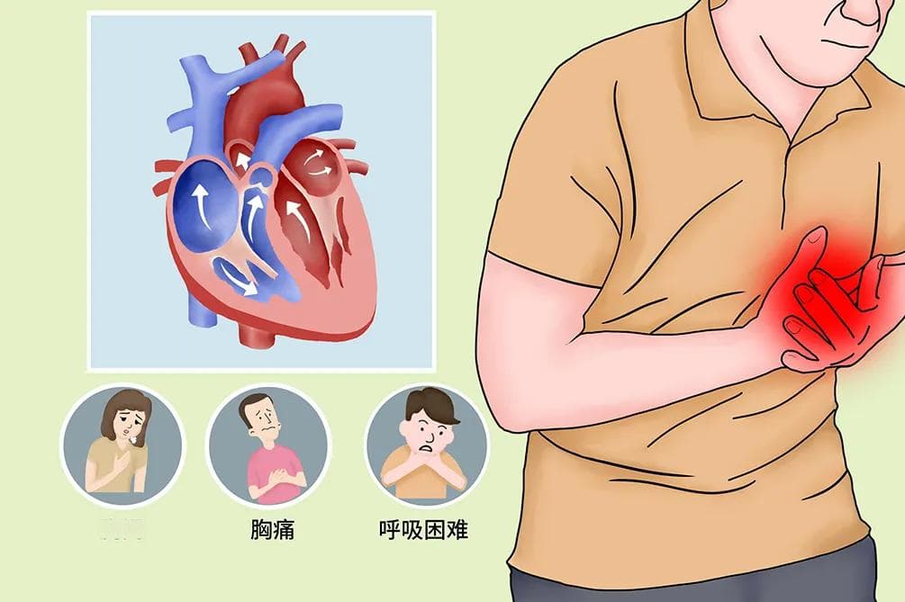 房室分离：定义、症状、诊断与治疗全解析