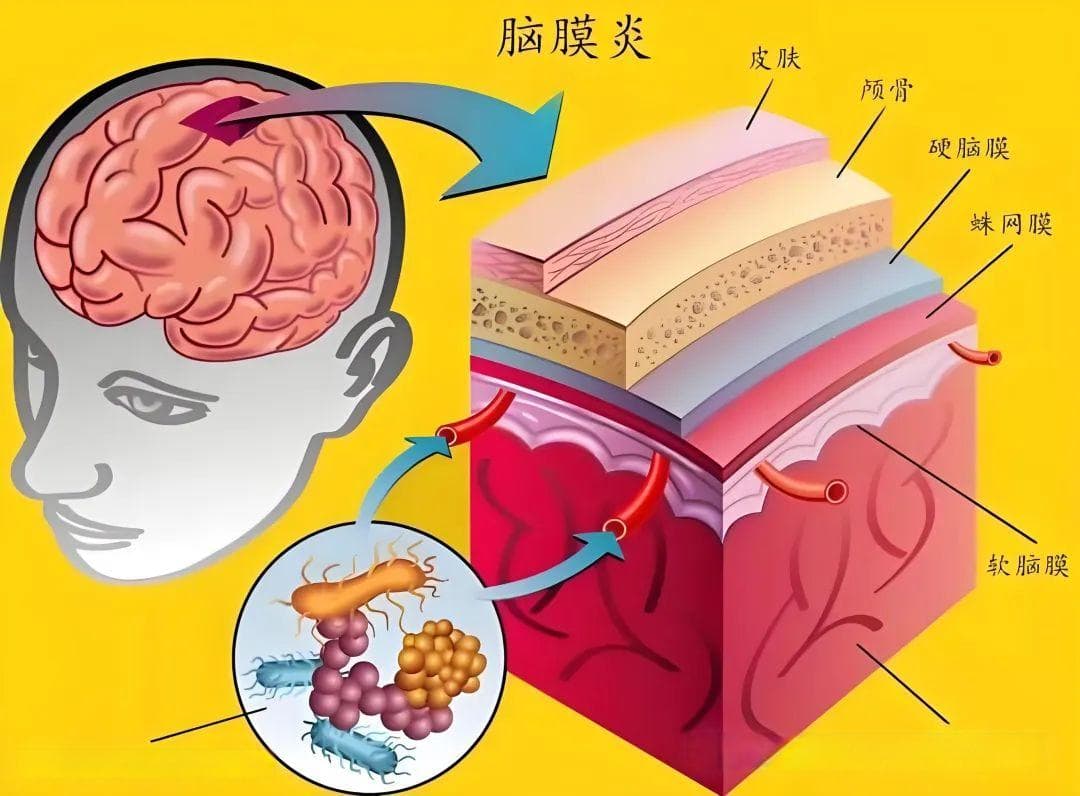 头痛这样分类，更便于临床诊断