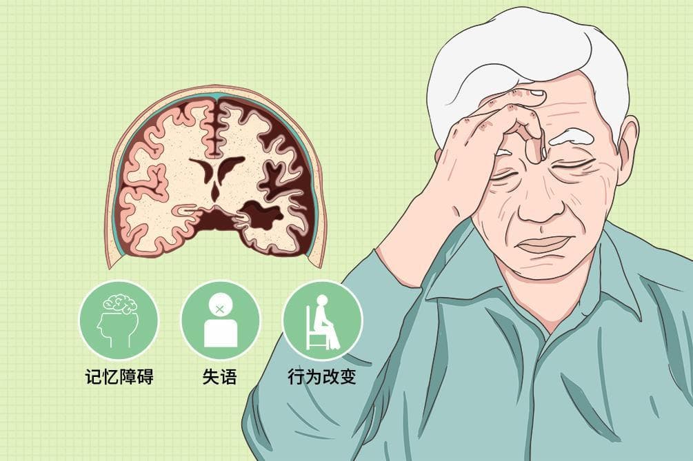 阿尔茨海默病的五种诊断方法