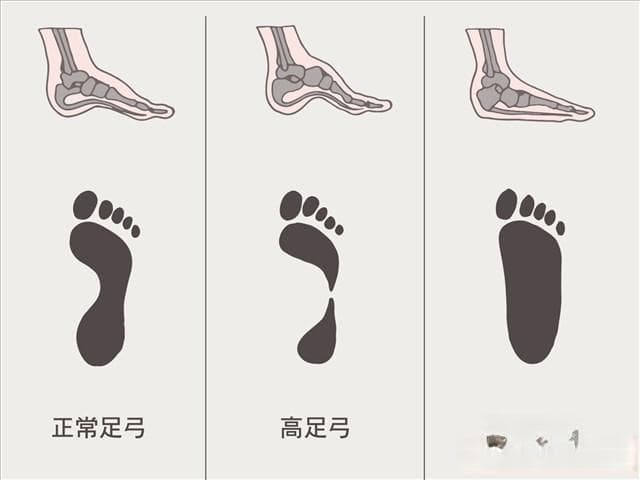 跑步新手必读：脚型、体重和用鞋场景如何挑选合适跑鞋