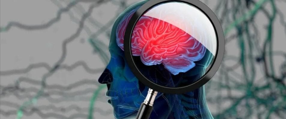经常出现5种症状 很可能是脑缺血的信号