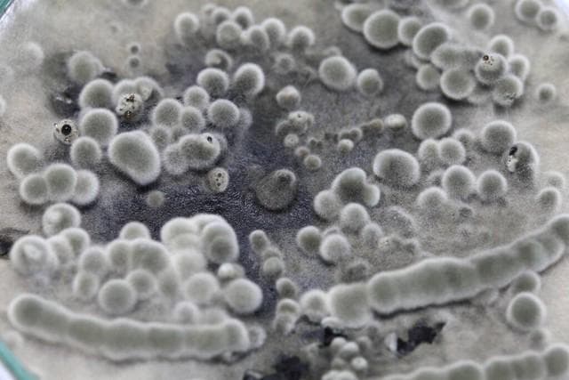 微生物界的“隐形杀手”——霉菌