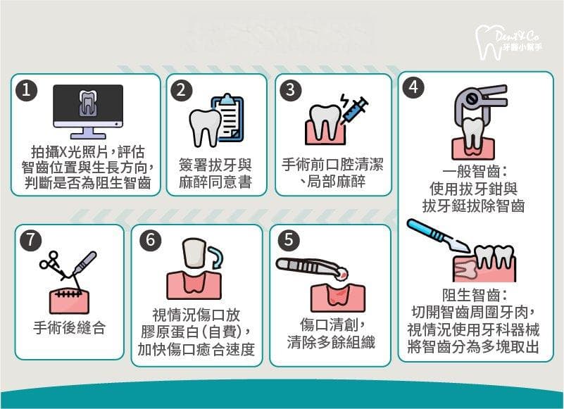 拔智齿多久会好，术前术后注意原则及照护方法！