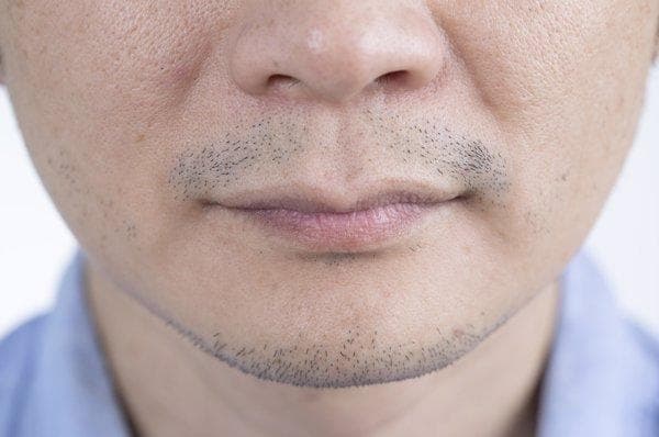 鼻毛可以剪吗？从健康角度解析鼻毛的生理功能