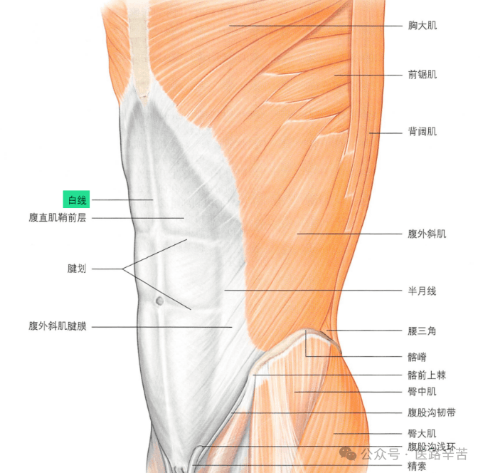 白线疝的诊断与手术治疗