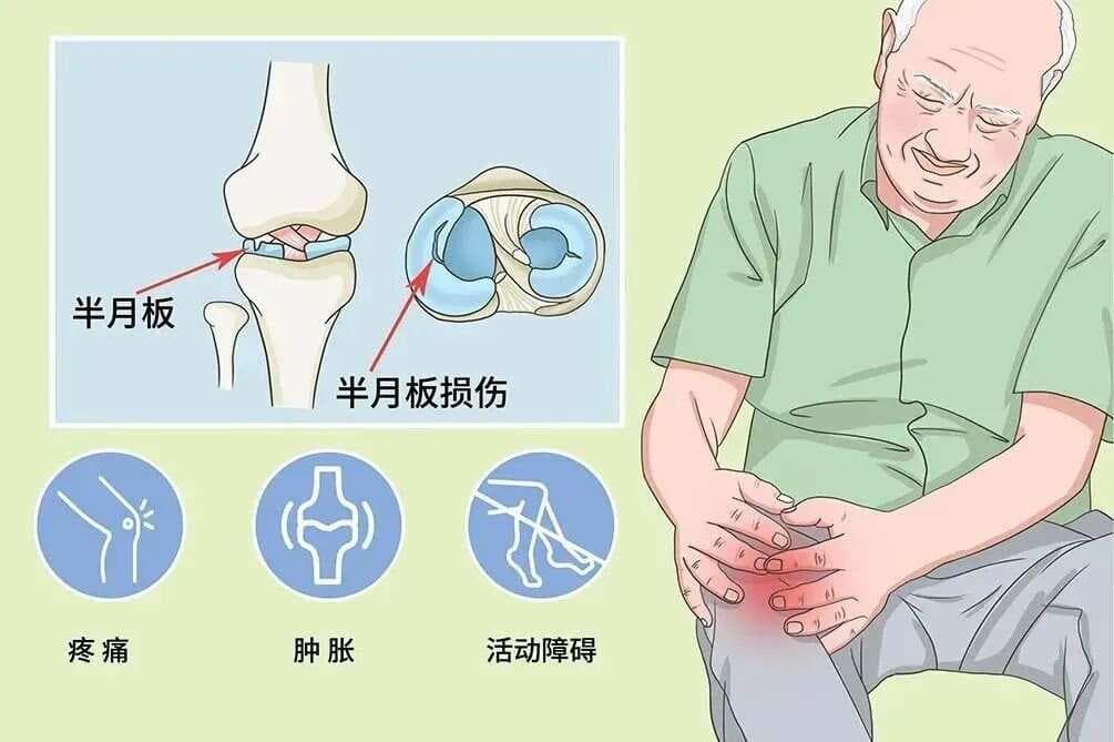 不同位置膝盖疼，预示不同疾病！保养膝关节，五招需谨记！