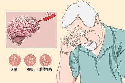 高血压脑出血后遗症居家护理指南