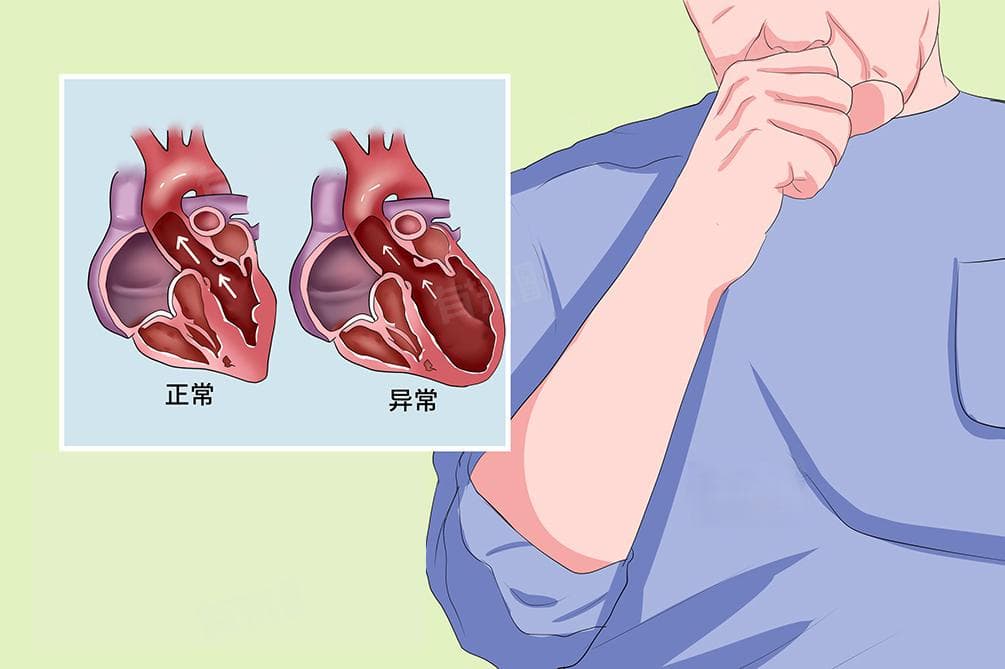 肺心病怎么治疗