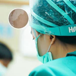补骨脂涂抹白斑的正确方法