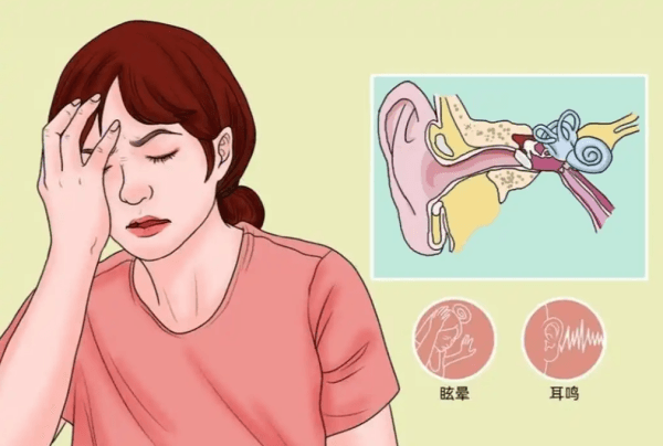 耳鸣用不用检查？