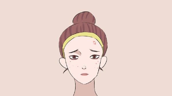 消除痘痘痘印的有效方法