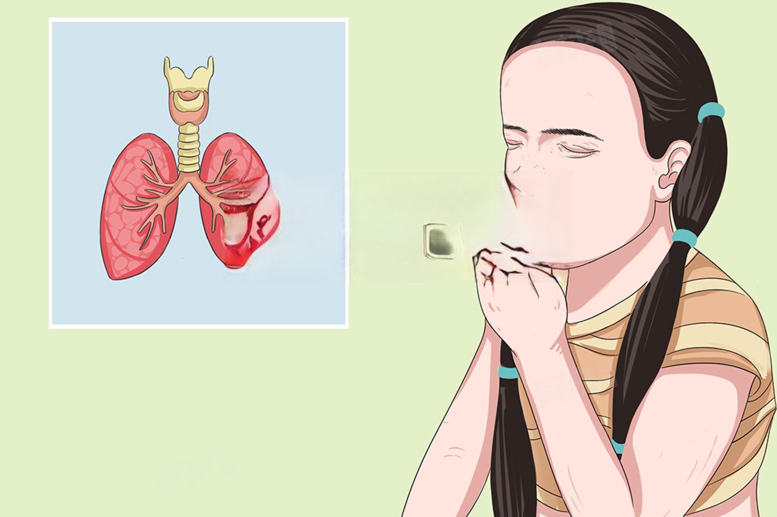 儿童早上咳嗽属于什么咳嗽