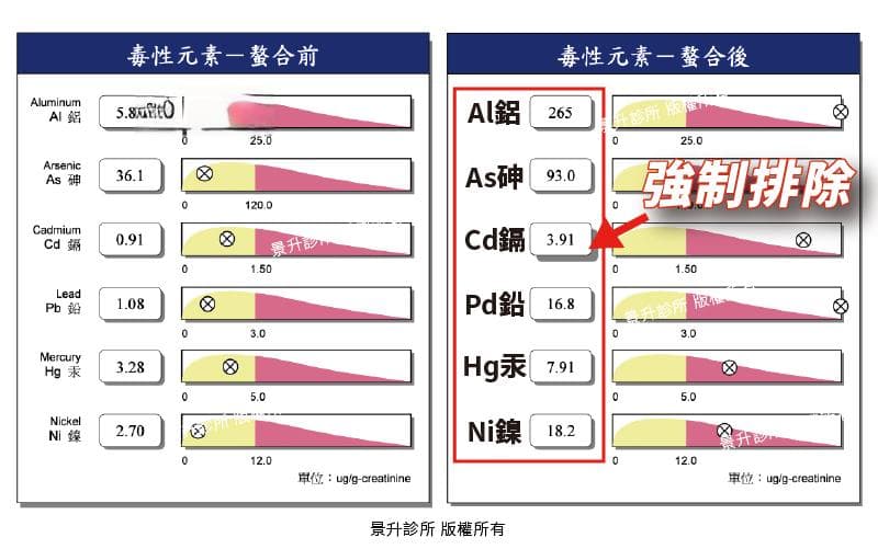 重金屬排除螯合治療：原理、效果與常見問題