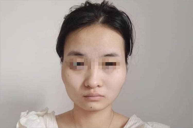 为什么颧骨这么高