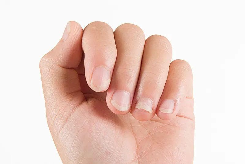 指甲与健康的关系：这些变化可能暗藏风险，科学护理指南请收好