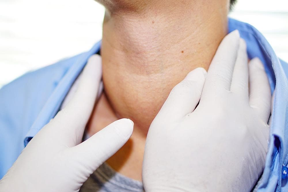 甲状腺结节要开刀吗？医详解：成因、症状、饮食及「甲状腺消融术」最新免开刀治疗方法