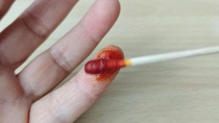 手被不小心割破了，第一时间并非立即贴创口贴，教你正确处理方法