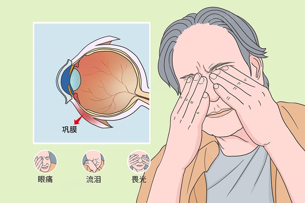 雷特综合征是什么