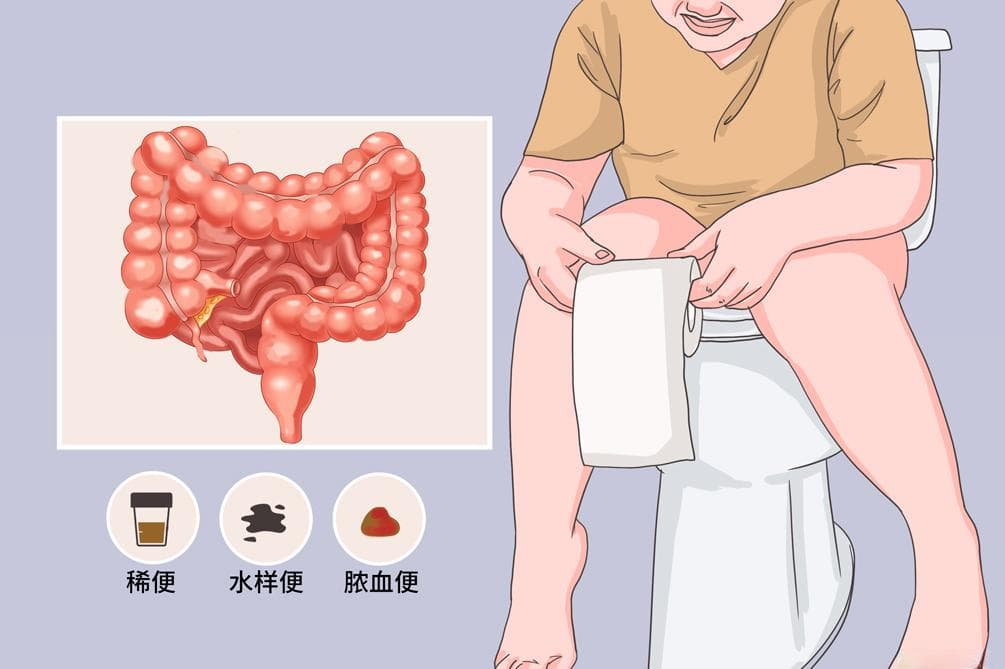 肠炎宁片和黄连素可以一起吃吗