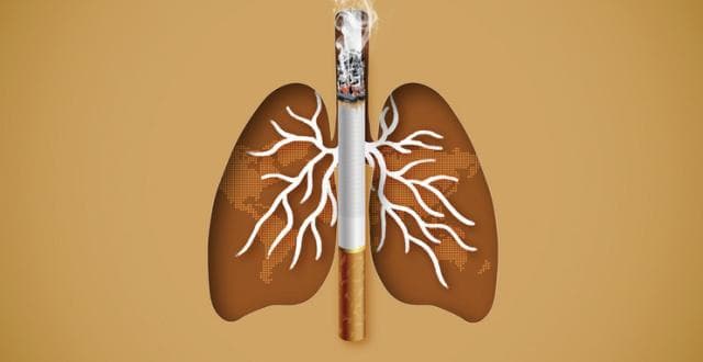 肺多发磨玻璃结节（GGN）随访策略：科学管理，早期发现