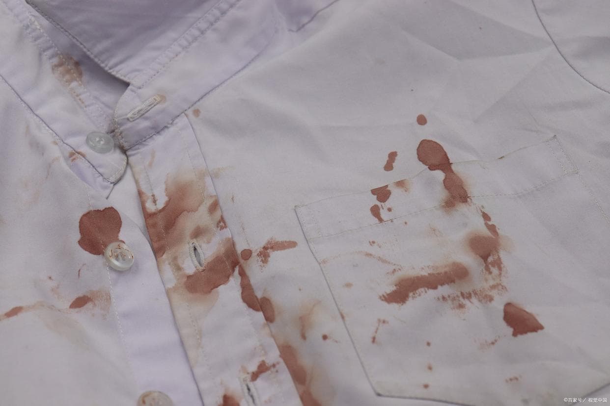 茶渍干了白色衣服怎么去除？妙招与科学原理的完美结合