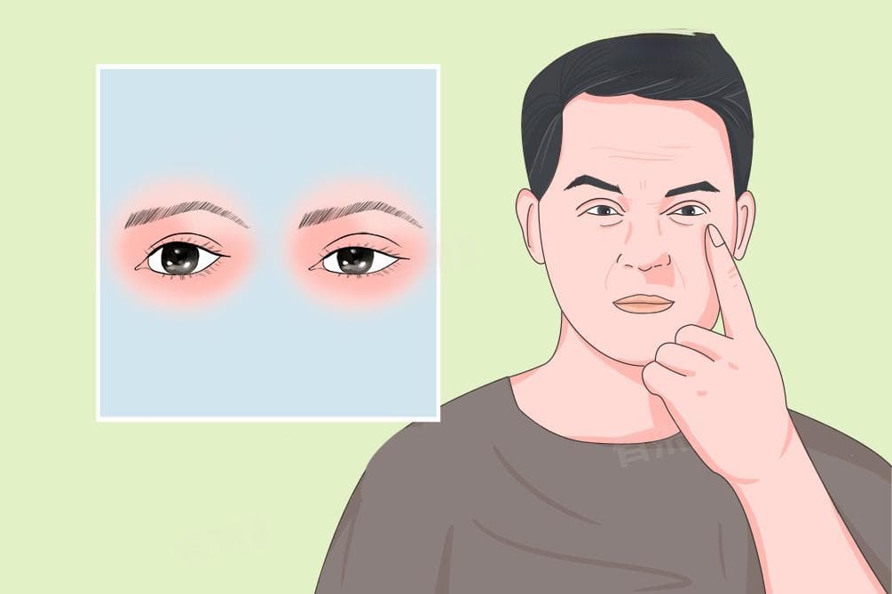 左眼上眼皮跳
