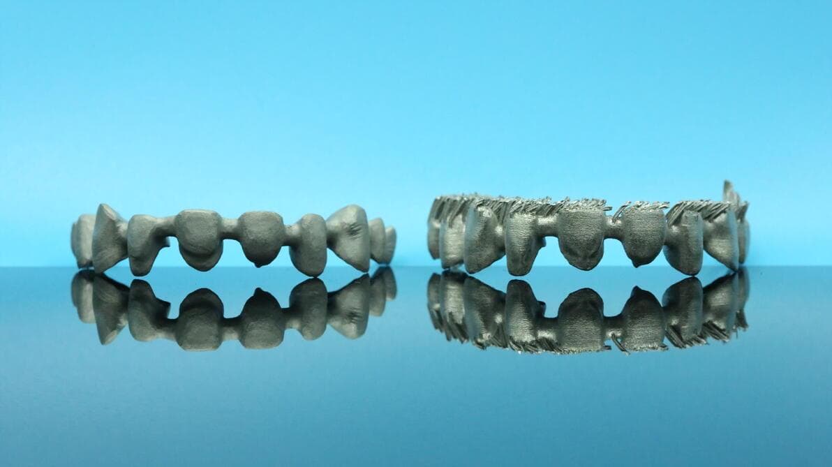 金属3D打印在生物医疗中的革新应用与未来展望